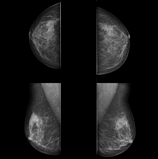 MX-600 · Clinical images 6